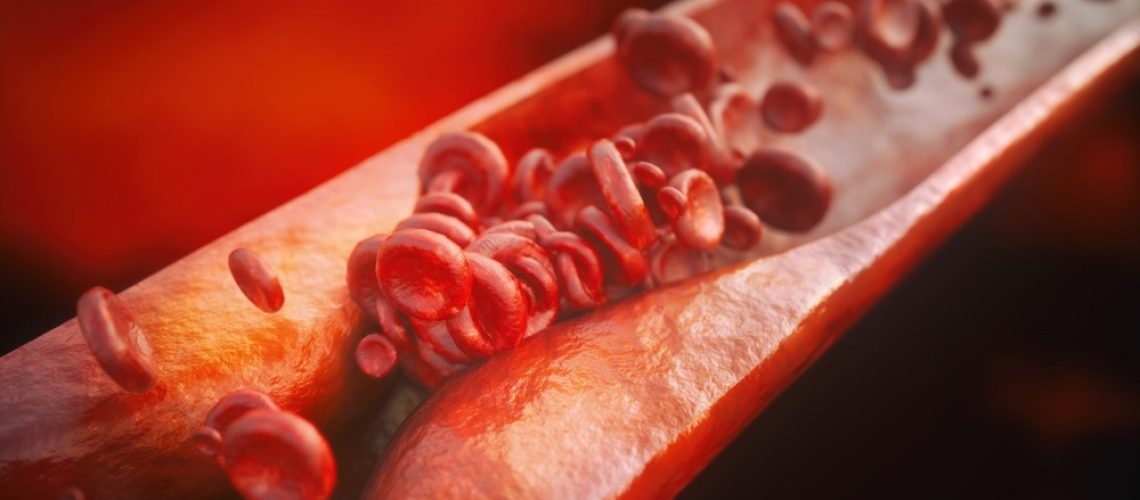 Study: Identification of a leucine-mediated threshold effect governing macrophage mTOR signalling and cardiovascular risk. Image Credit: Crevis/Shutterstock.com