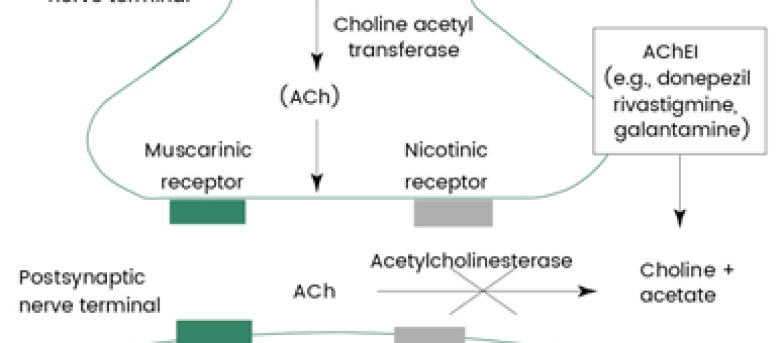FDA approves AChEI ALPHA-1062 for alzheimer’s disease treatment