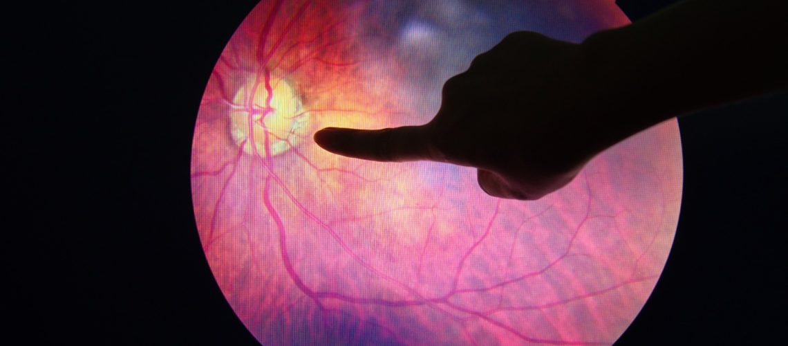 Study: A deep learning system for predicting time to progression of diabetic retinopathy. Image Credit: Anukool Manoton / Shutterstock