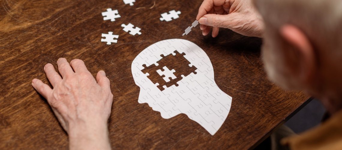 Study: Posttraumatic Epilepsy and Dementia Risk. Image Credit: LightField Studios/Shutterstock.com