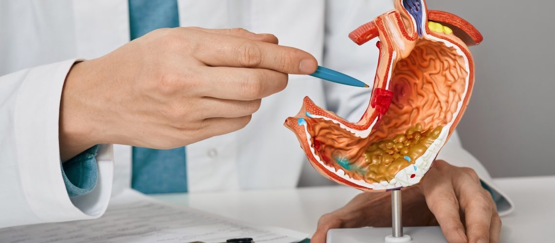 Study: Review of dietary patterns and gastric cancer risk: epidemiology and biological evidence. Image Credit: Peakstock/Shutterstock.com
