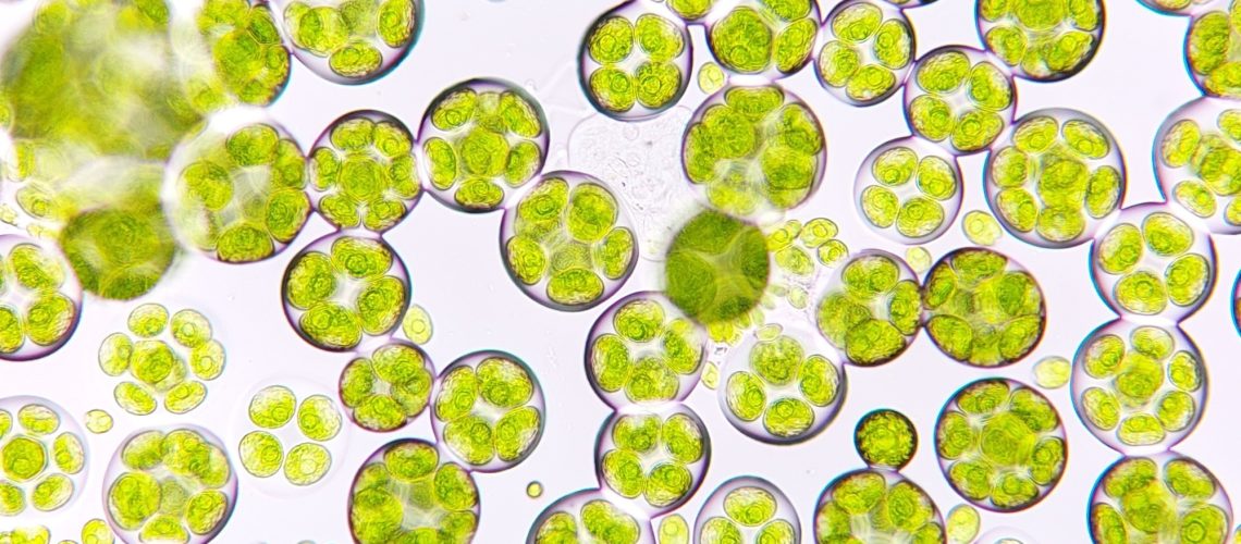 Freshwater microalgae blooming under microscope