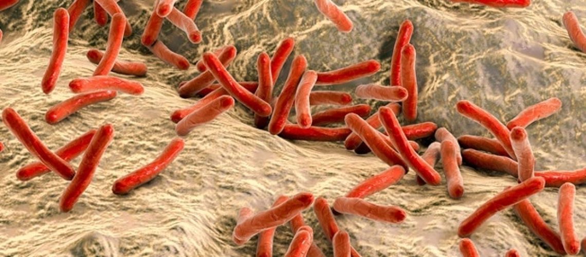 האם זה מפיץ צרעת בפלורידה?