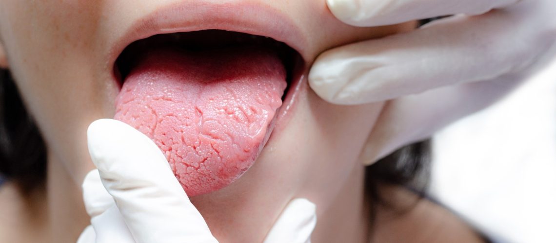 Tongue of a young Caucasian woman