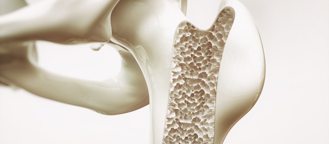 Review: The Impact of Fermented Dairy Products and Probiotics on Bone Health Improvement. Image Credit: Crevis / Shutterstock
