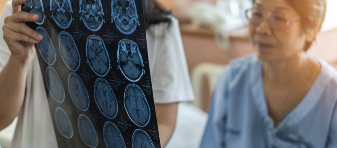 medical doctor diagnosing elderly ageing patient neurodegenerative illness problem seeing Magnetic Resonance Imaging (MRI) film
