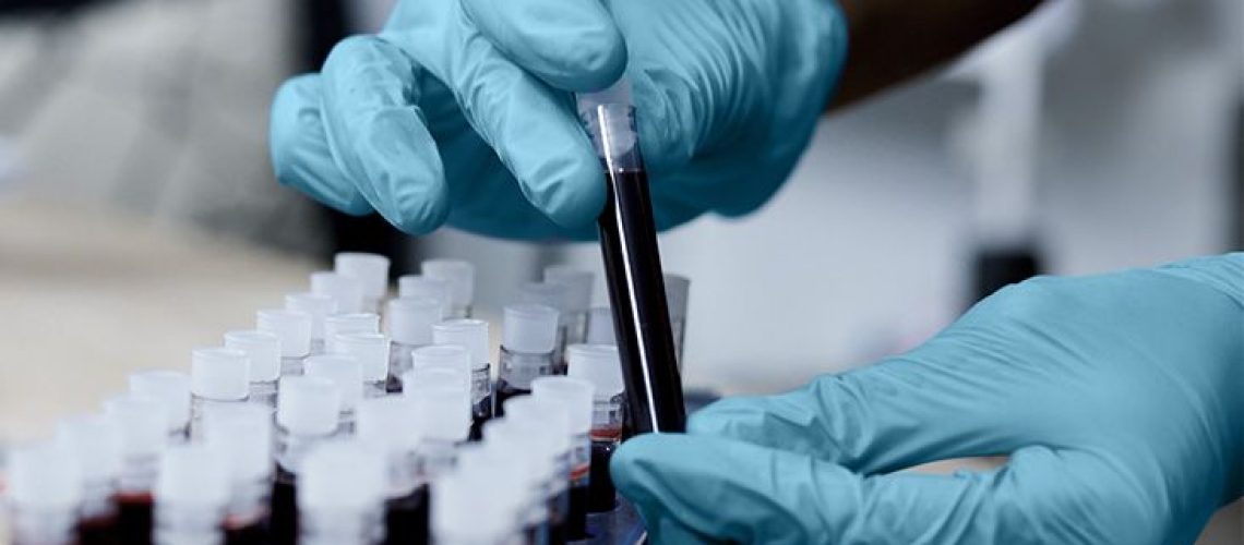 האם רמזים חדשים לגבי כמה זמן משפיע COVID על מערכת החיסון יכולים להוביל לטיפול?