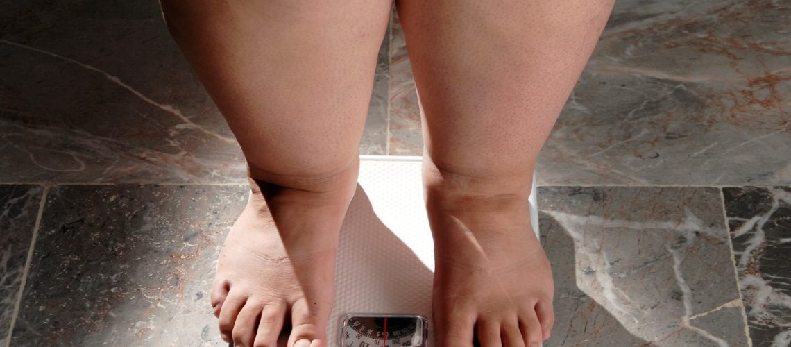 Study: Energy expenditure and obesity across the economic spectrum. Image Credit: Valente Romero / Shutterstock
