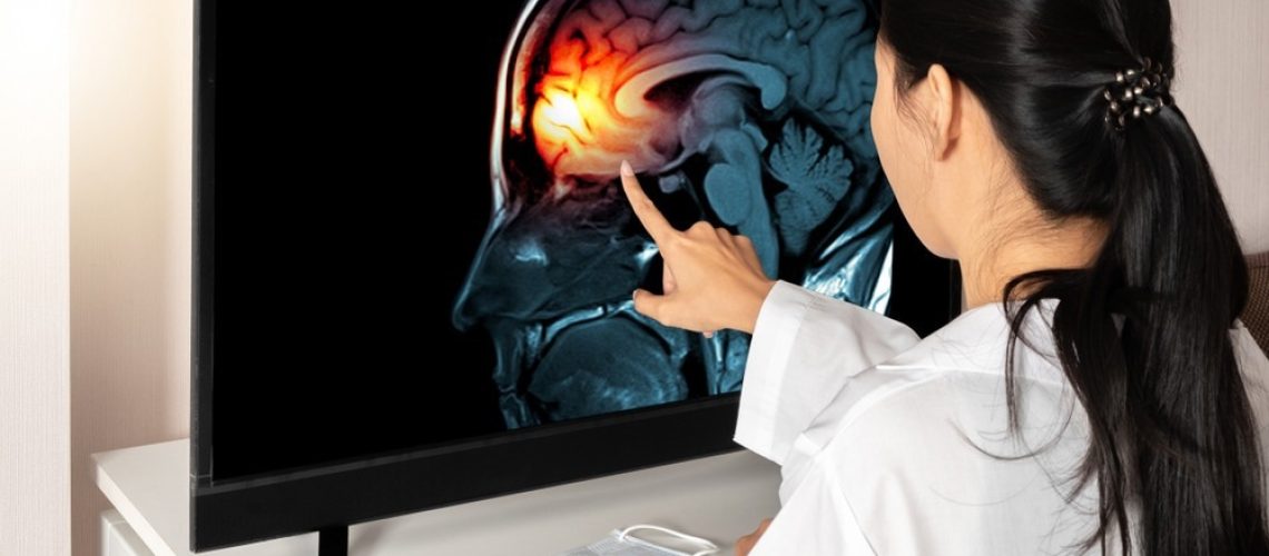 Study: Divergent landscapes of A-to-I editing in postmortem and living human brain. Image Credit: steph photographies/Shutterstock.com