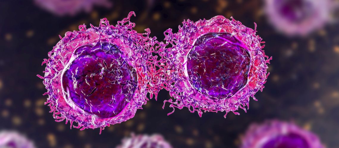 הבנת ההשפעה של BMI על הסיכון לסרטן המעי הגס באסיה