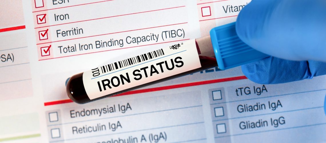 Study: Prevalence of Iron Deficiency Using 3 Definitions Among Women in the US and Canada. Image Credit: angellodeco/Shutterstock.com