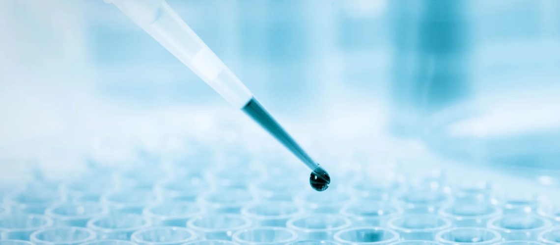 Study: Metabolomic aging and mortality clocks based on ensemble learning identify systemic aging risk across the human life span in 18,476 individuals. Image Credit: luchschenF / Shutterstock