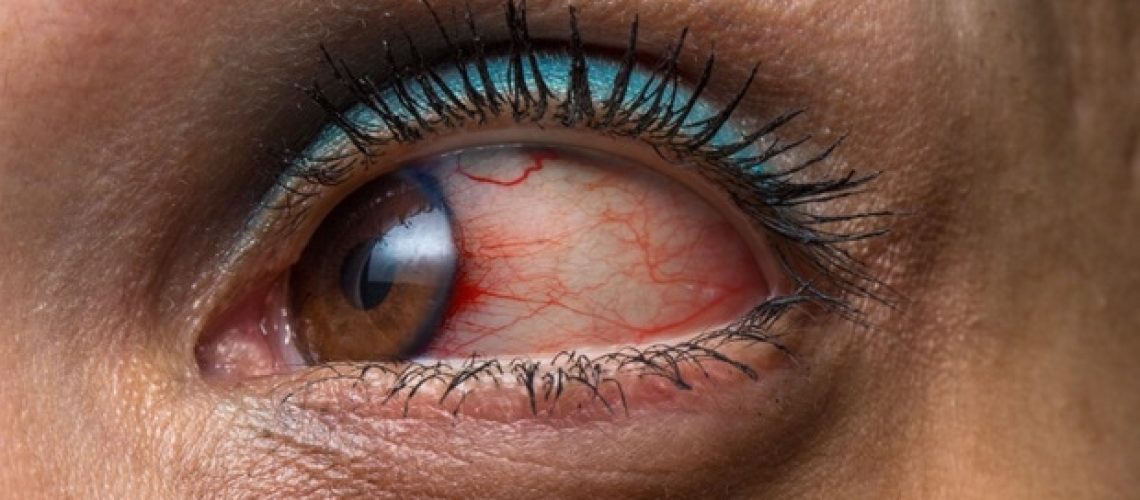 הדמיה באמצעות אוטופלואורסצנציה של קרקעית הקרקע יכולה להקל על האבחנה והניטור של מחלות עיניים נדירות