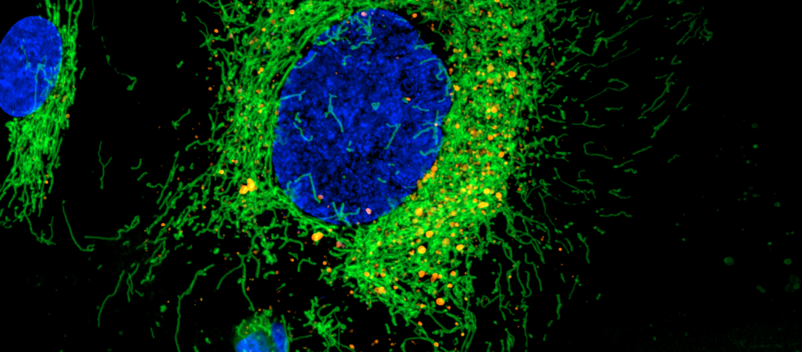 Hela Cells