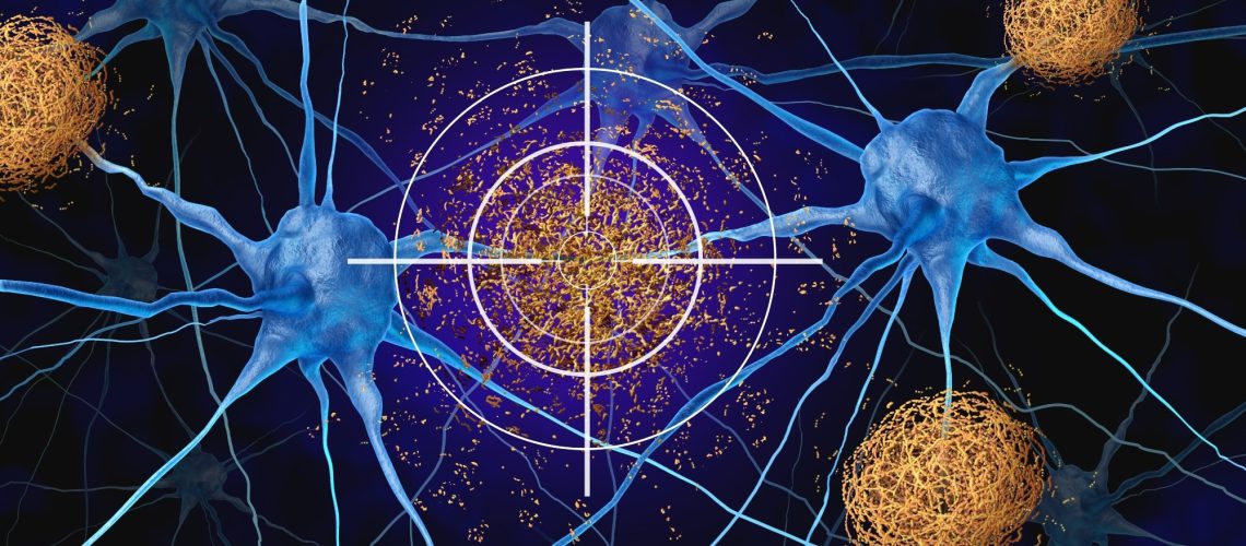 Study: APOE4 to APOE2 allelic switching in mice improves Alzheimer’s disease-related metabolic signatures, neuropathology and cognition. Image Credit: Lightspring / Shutterstock