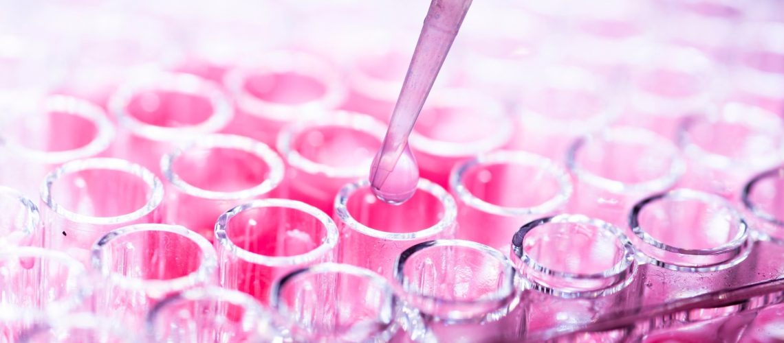 cell culture