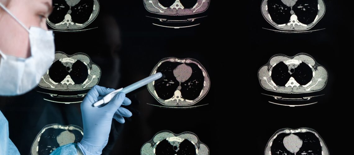 Study: Accelerated brain ageing during the COVID-19 pandemic. Image Credit: Shyntartanya / Shuttertock
