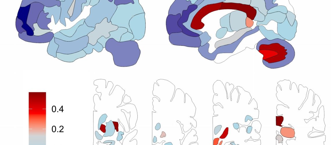 World’s first map of human brain lipids created