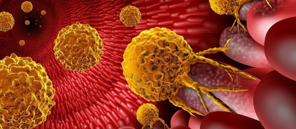 Study: Global, regional, and national lifetime risks of developing and dying from gastrointestinal cancers in 185 countries: a population-based systematic analysis of GLOBOCAN. Image Credit: Lightspring/Shutterstock.com