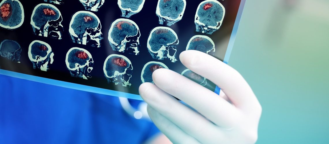 Review: Identifying and reducing risks of neurological complications associated with vaccination. Image Credit: sfam_photo / Shutterstock