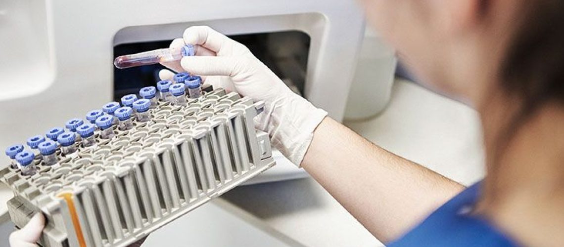 השמנת יתר קשורה למבשר לסרטן דם מיאלומה נפוצה