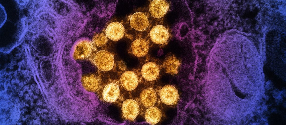 Rapid Communication: Humoral immune escape by current SARS-CoV-2 variants BA.2.86 and JN.1, December 2023. Image Credit: NIAID