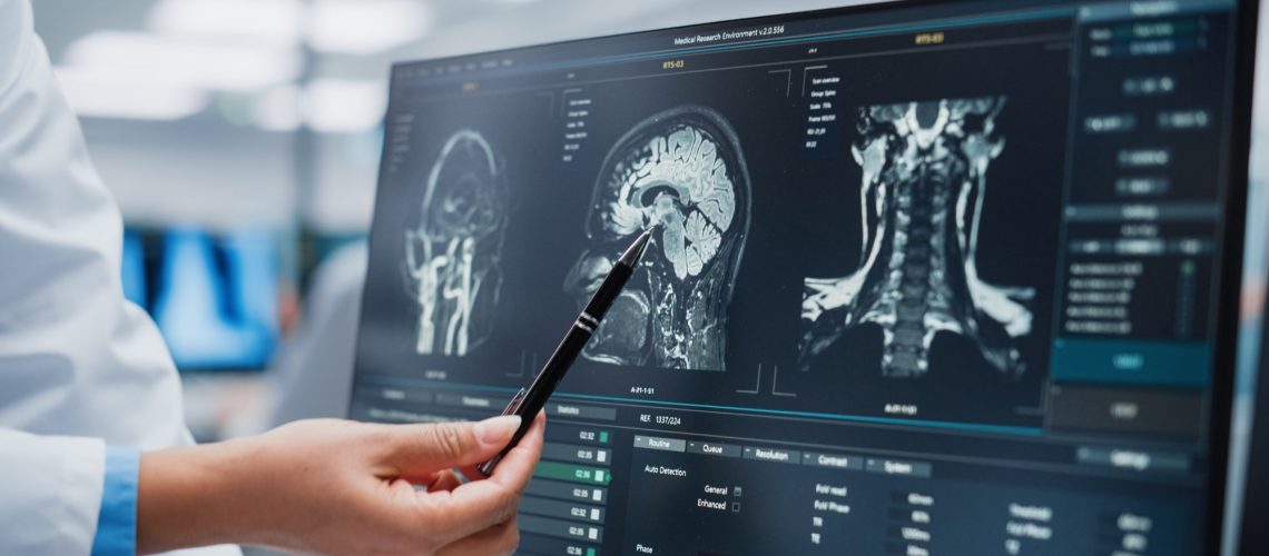Study: Trends in Intracranial and Cerebral Volumes of Framingham Heart Study Participants Born 1930 to 1970. Image Credit: Gorodenkoff/Shutterstock.com