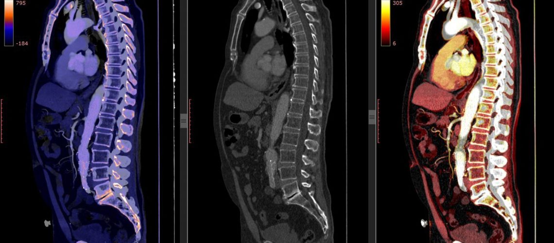Review Article: A guide to artificial intelligence for cancer researchers