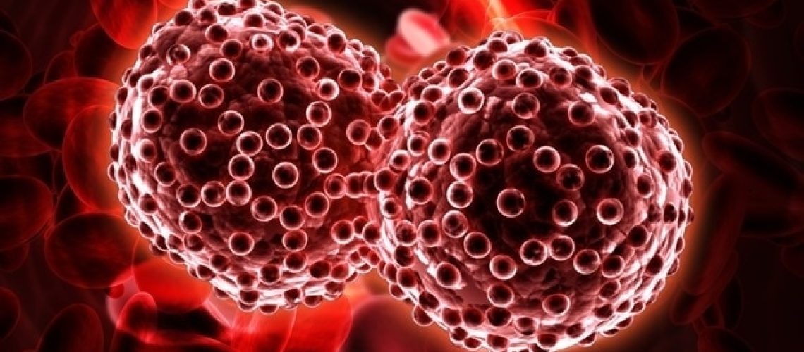 חוקרים חושפים את תפקידם של גרסאות גנטיות תורשתיות בסרטן דם מסוג נדיר