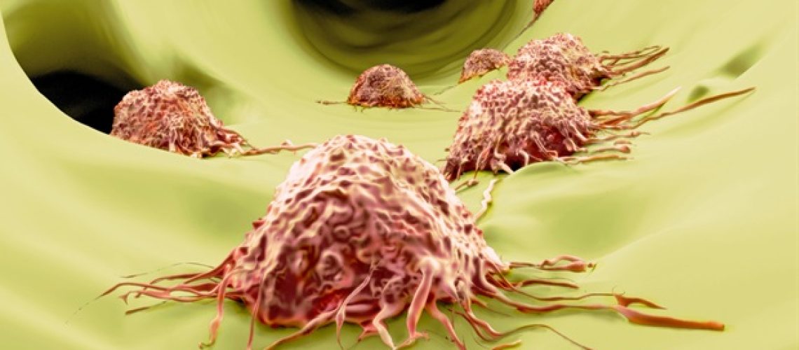 חוקרים מגלים סוג חדש של תרכובות המכוונות לתאי גזע סרטניים