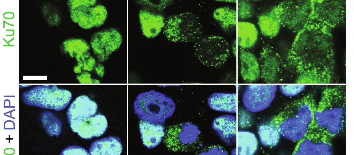 Study: Ku70 senses cytosolic DNA and assembles a tumor-suppressive signalosome