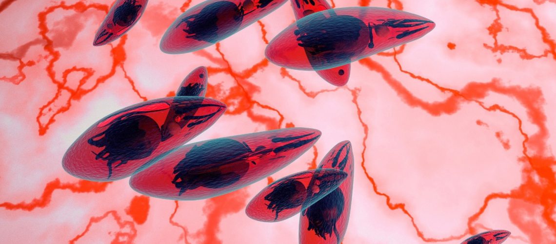 Review: Systematic review and modelling of Toxoplasma gondii seroprevalence in humans, Europe, 2000 to 2021. Image Credit: fotovapl / Shutterstock