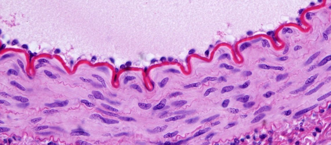 Cross-sectioned muscular artery