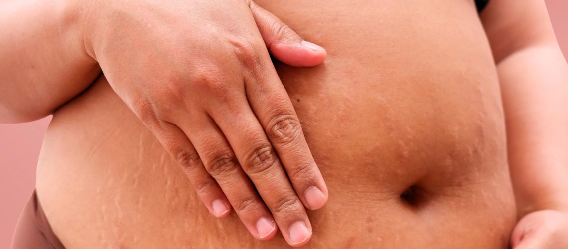Study: Pregnancy outcomes following maternal GLP-1 receptor agonist exposure: a systematic review and meta-analysis. Image Credit: While of My Desk / Shutterstock