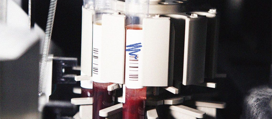 'חתימות' חלבון בבדיקת דם בודדת עשויות לסייע באיתור למעלה מ-60 מצבים