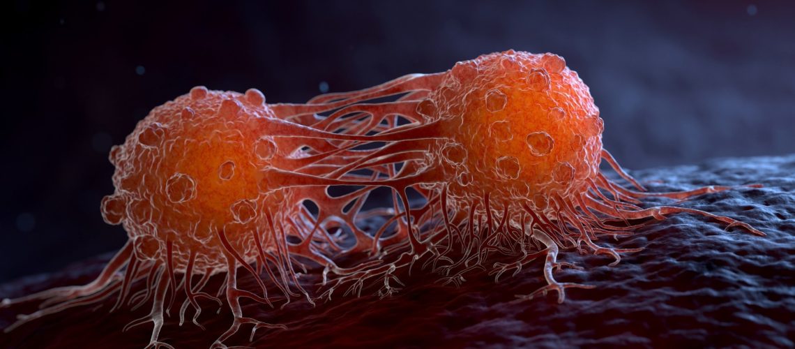 Study: Chemical exposomics in biobanked plasma samples and associations with breast cancer risk factors. Image Credit: Tatiana Shepeleva / Shutterstock