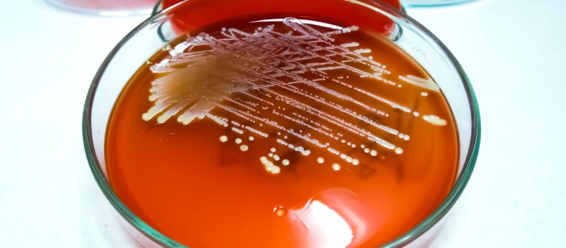 Staphylococcus aureus: Gram-positive, to Gram-variable, nonmotile, Coccus, beta hemolysis, saprotrophic bacterium.