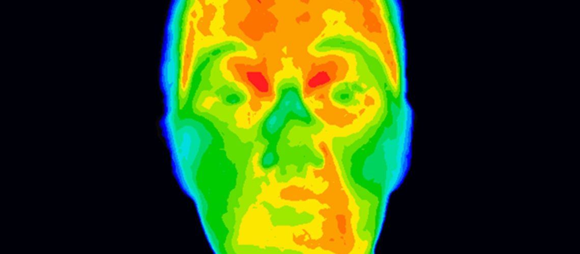 Study: Prediction of coronary artery disease based on facial temperature information captured by non-contact infrared thermography. Image Credit: Anita van den Broek / Shutterstock