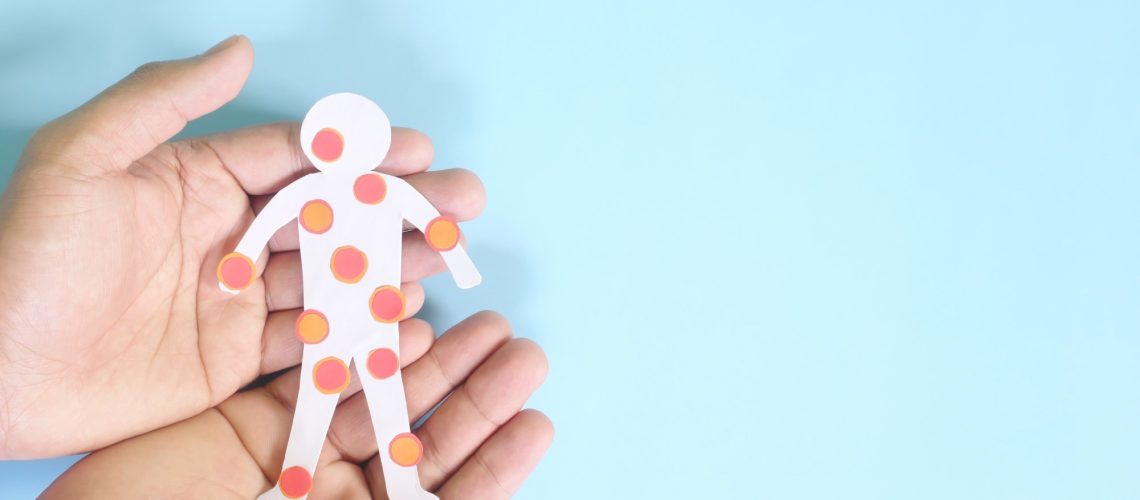 Study: Measles — United States, January 1, 2020–March 28, 2024. Image Credit: sulit.photos/Shutterstock.com