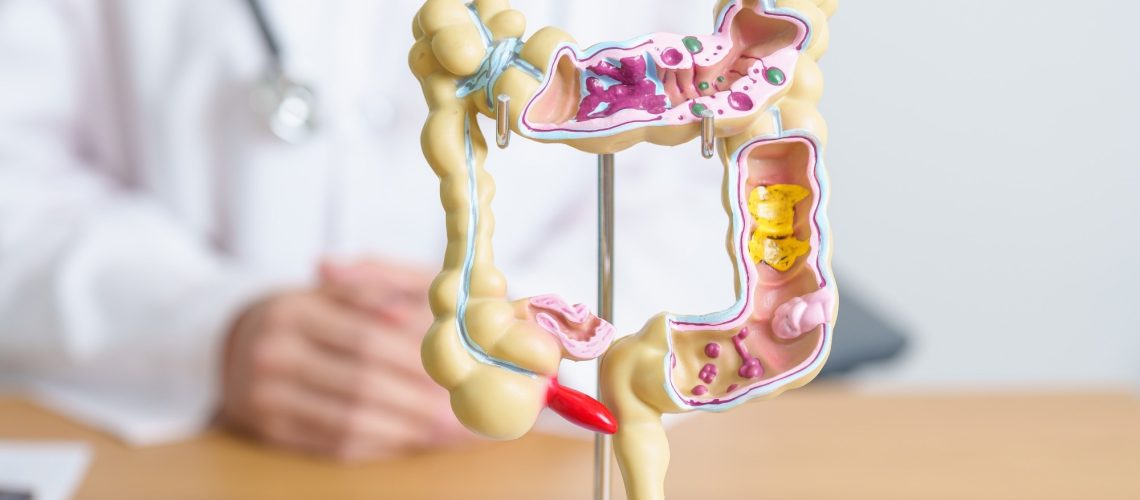 Study: Red Flag Signs and Symptoms for Patients With Early-Onset Colorectal Cancer. Image Credit: Jo Panuwat D / Shutterstock