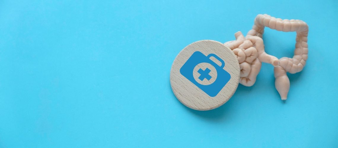 Study: Effect of curcumin on the gut microbiota of patients with ulcerative colitis, Crohn’s disease and healthy participants. Image Credit: Faizal Ramli / Shutterstock