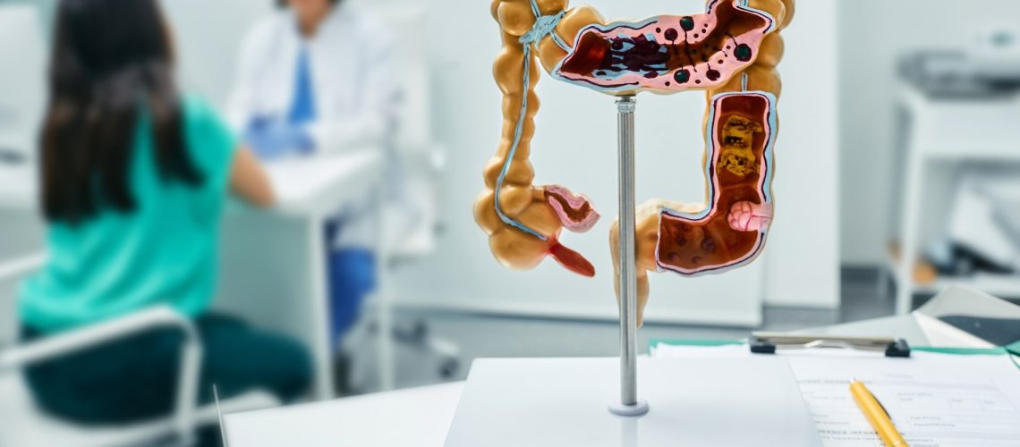 Study: Tissue-specific genetic variation suggests distinct molecular pathways between body shape phenotypes and colorectal cancer. Image Credit: Peakstock / Shutterstock.com