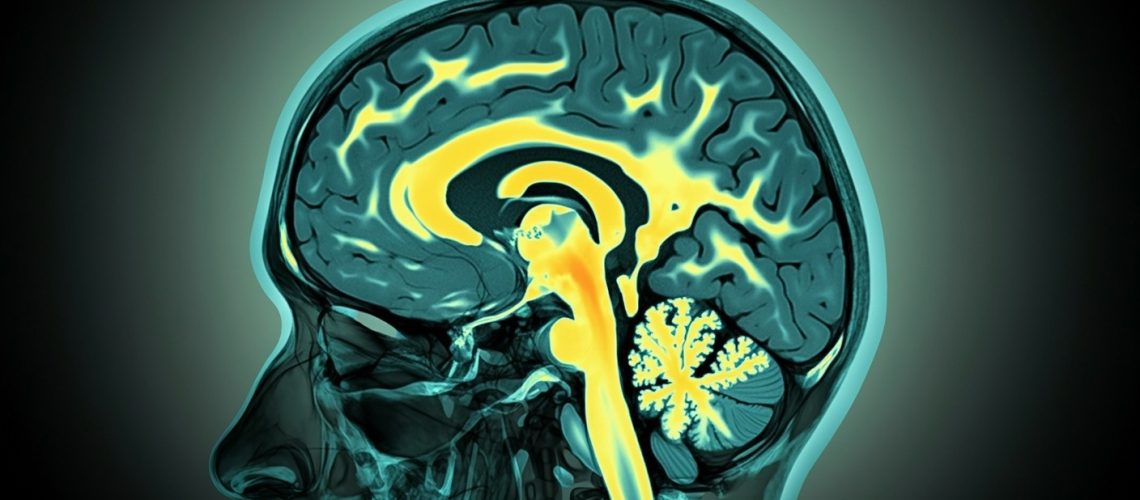 Study: The Concurrent Association of Magnesium and Calcium Deficiencies with Cognitive Function in Older Hospitalized Adults. Image Credit: Shutterstock AI / Shutterstock.com