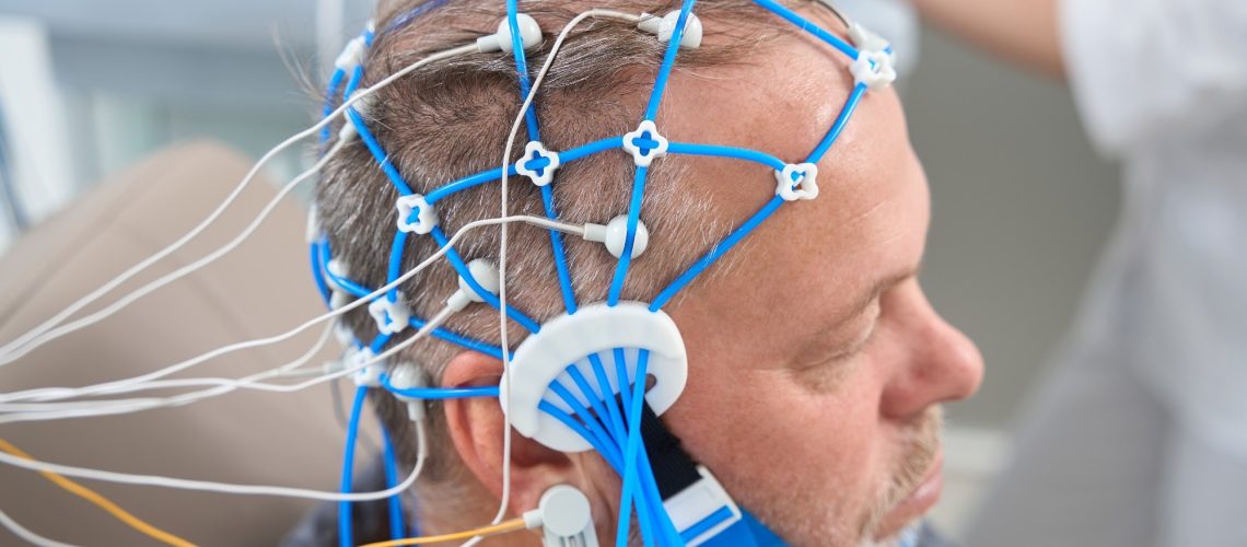 Patient undergoing an EEG encephalography diagnostic procedure
