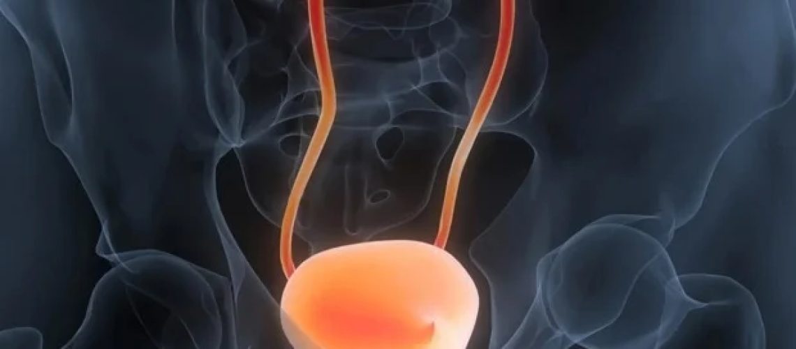 לראות את הבלתי נראה בניתוח סרטן שלפוחית ​​השתן