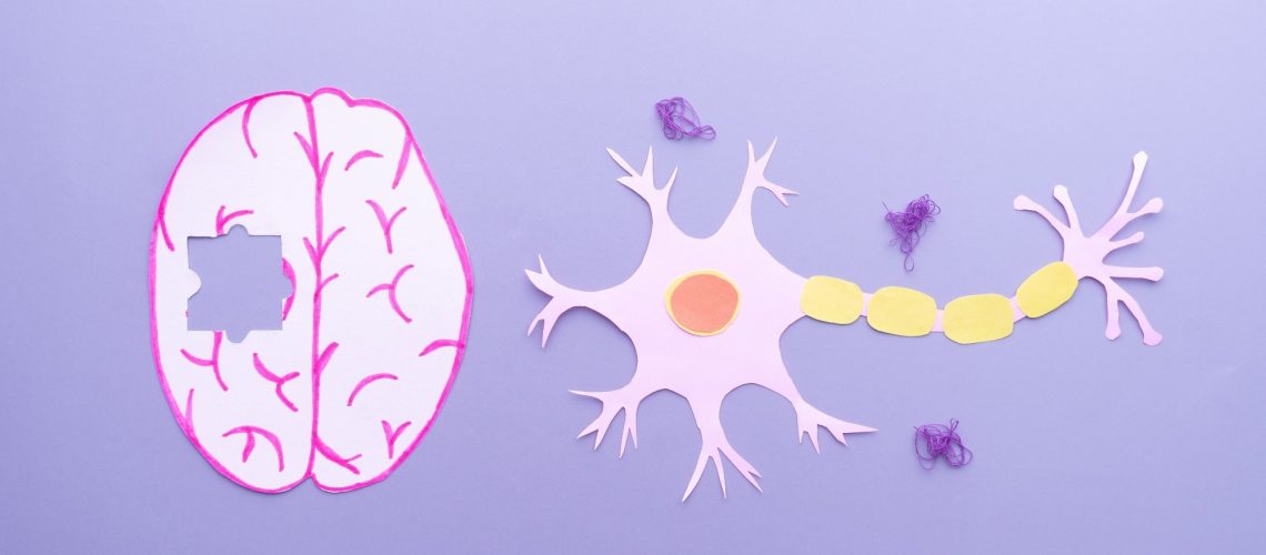 Study: Primary care detection of Alzheimer’s disease using a self-administered digital cognitive test and blood biomarkers. Image Credit: Orawan Pattarawimonchai / Shutterstock