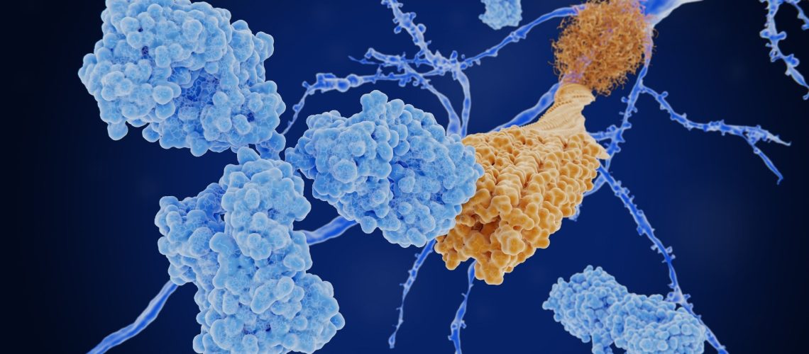 Perspective: Considering challenges for the new Alzheimer