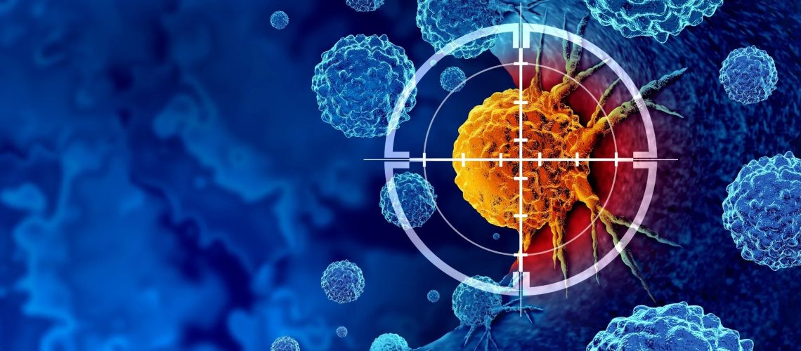 Perspective: Accelerating discovery of cancer causes for prevention in the era of rising early-onset cancers. Image Credit: Lightspring / Shutterstock