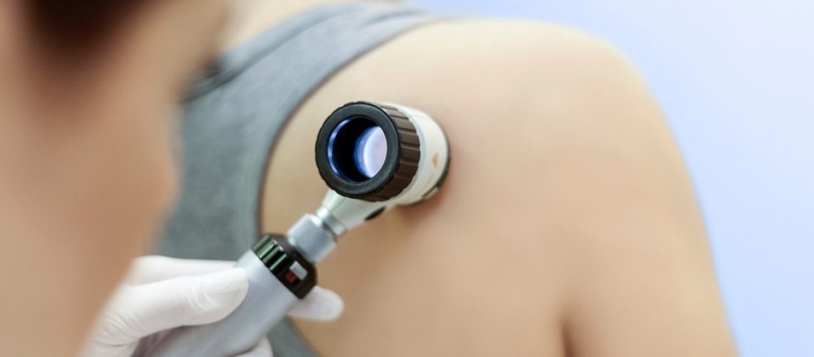 Study: Evidence-Based Communication to Increase Melanoma Knowledge and Skin Checks. Image Credit: Healthy Definition/Shutterstock.com