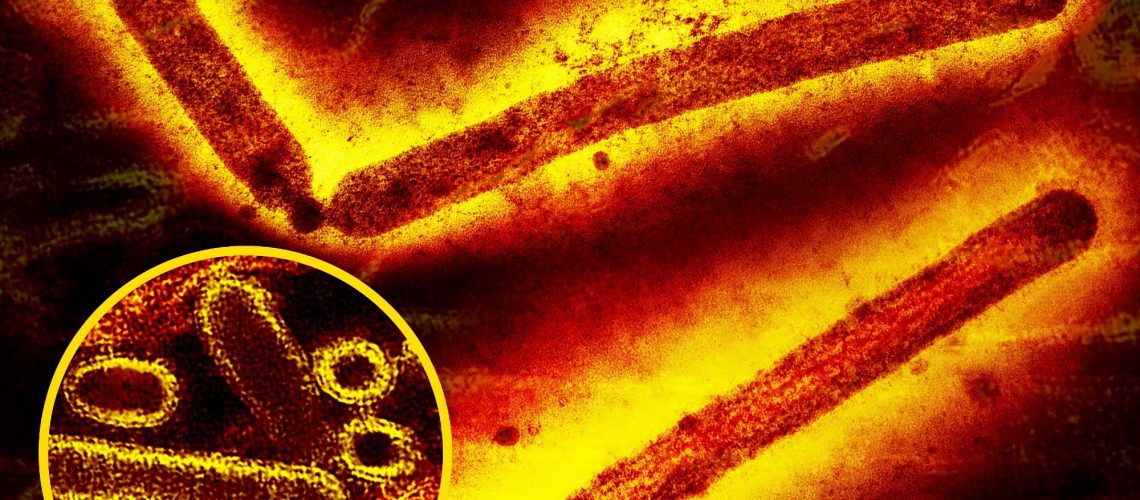 Influenza A (H5N1/bird flu) virus particles (round and rod-shaped; red and yellow). Creative composition and colorization/effects by NIAID; transmission electron micrograph imagery is courtesy CDC. Scale has been modified/not to scale. Credit: CDC and NIAID